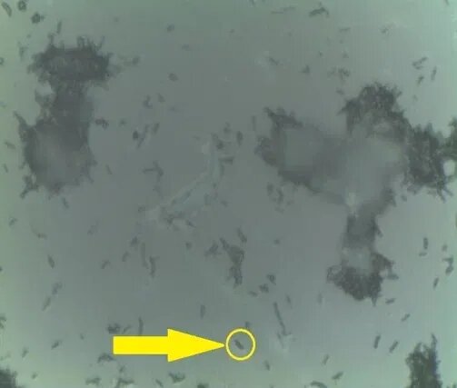 Фото микобактерий через оптический микроскоп с обозначением единичной клетки