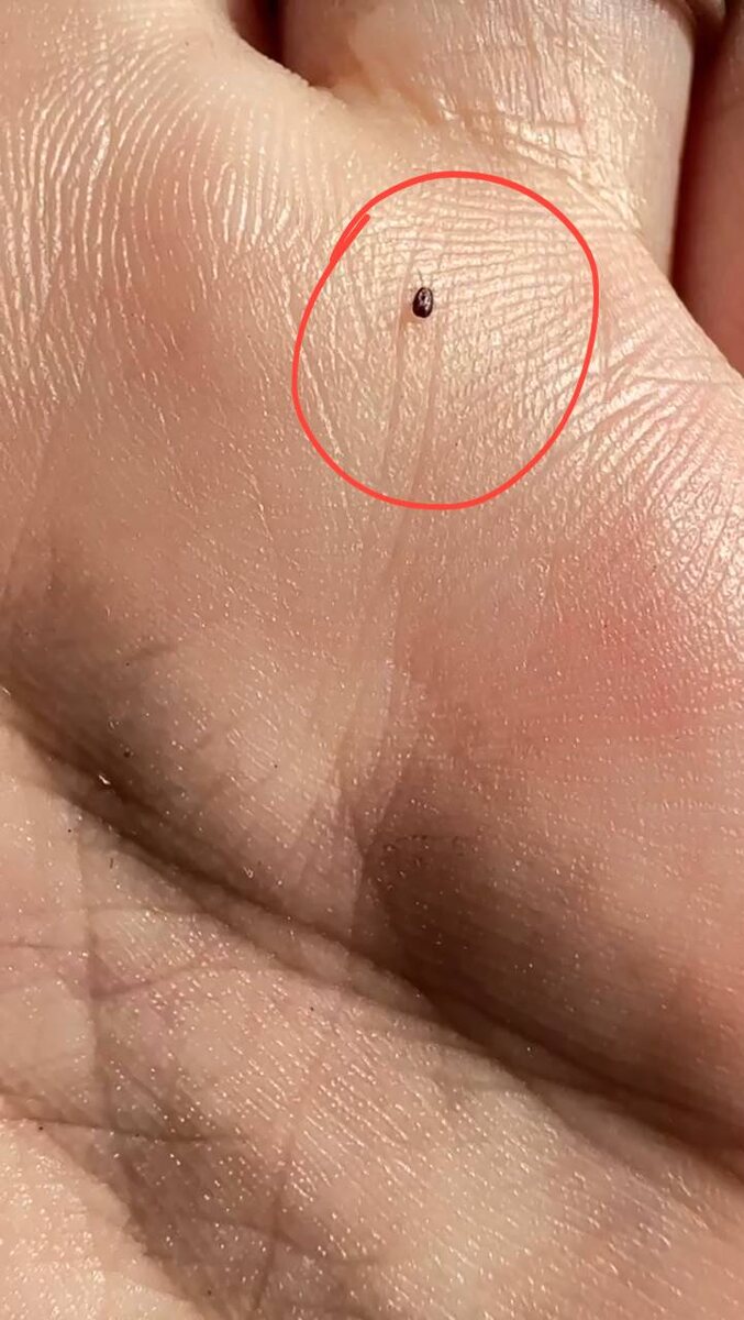 Куриный клещ при максимальном приближении c телефона