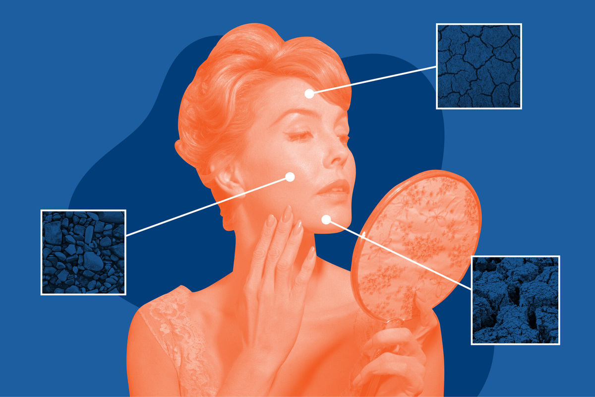     Вопрос эксперту: как происходит камуфляж рубцов