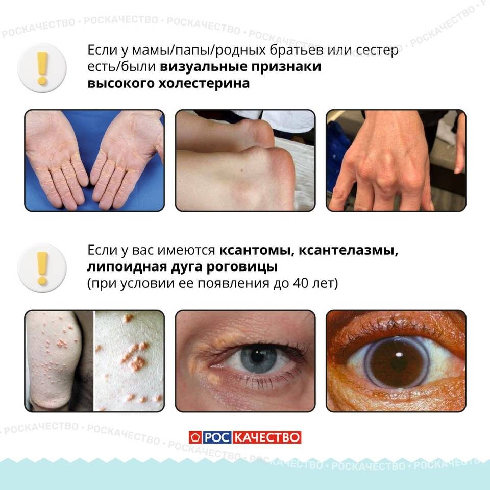    Фото: Роскачество