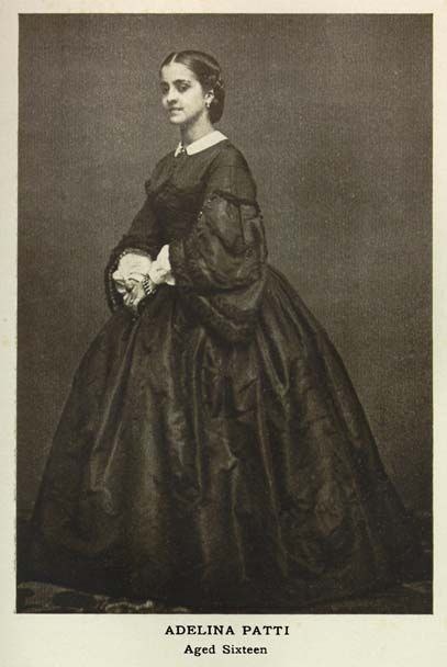 Аделина Патти. 1859.