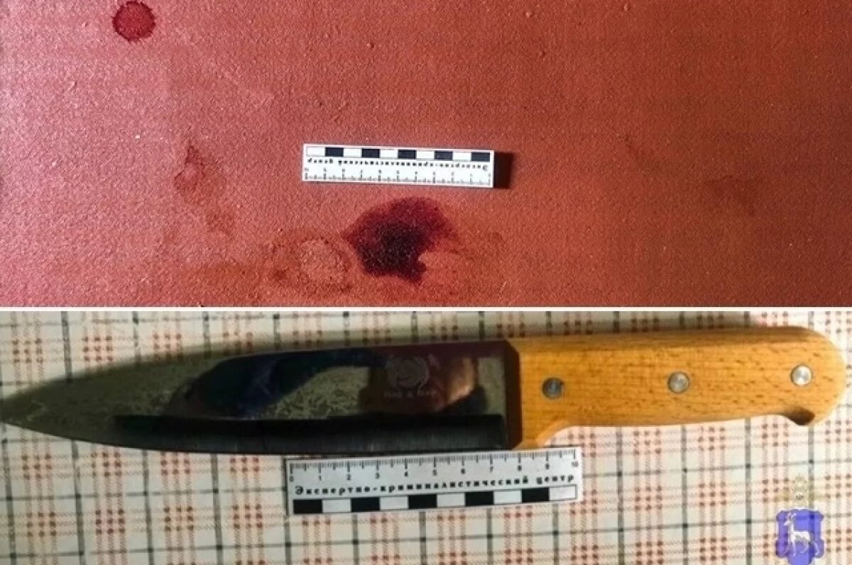    Тольяттинка во время ссоры несколько раз ударила ножом сожителя в живот