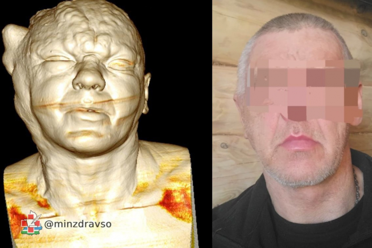    Фото: министерство здравоохранения Свердловской области