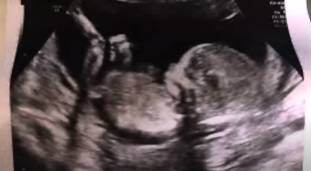 Поддельные фото Меган Маркл с «доски желаний». Беременные фото — липа?