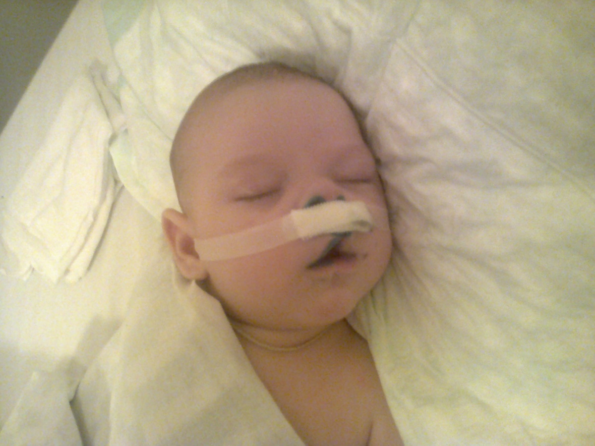 Сразу после операции