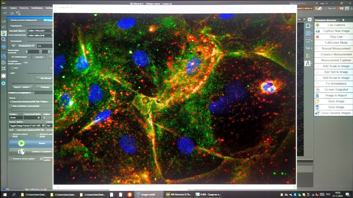 Эпителиальные клетки щеки кошки меченные антителами к р16 - зеленый (маркер стареющих клеток), красителем к митохондриям - красный и красителем к ядрам - синий.