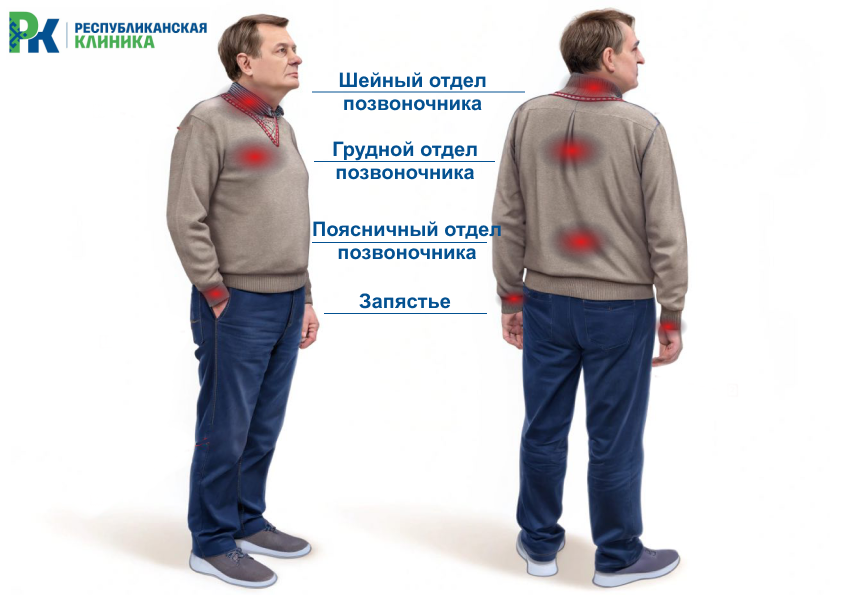 Защемление нерва