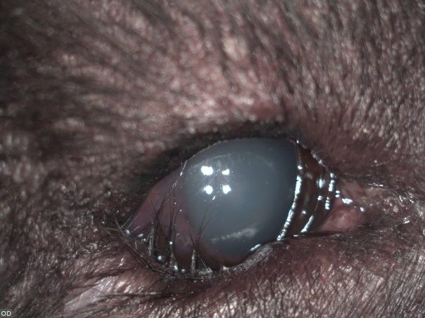 
Энтропион. Фото О.Ястребова