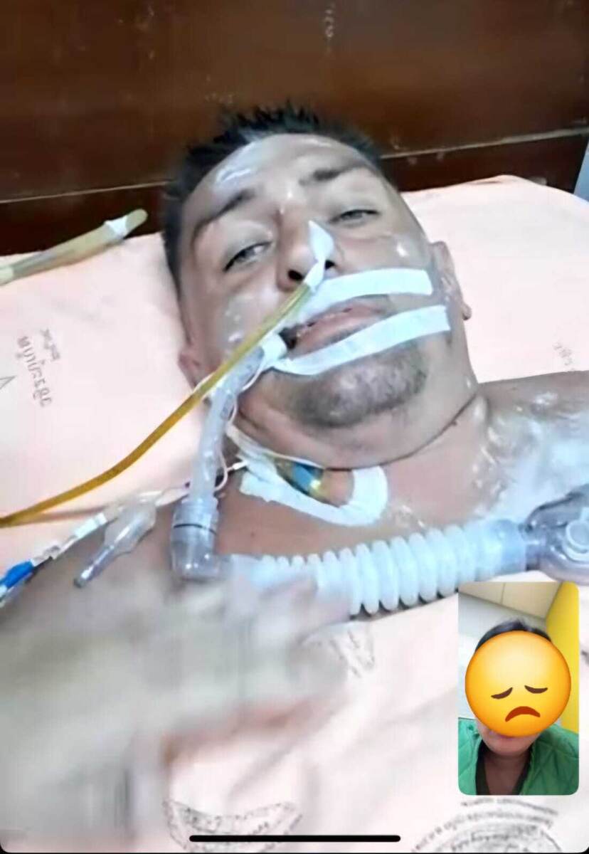 Сергей в сознании, только ходить не может. 