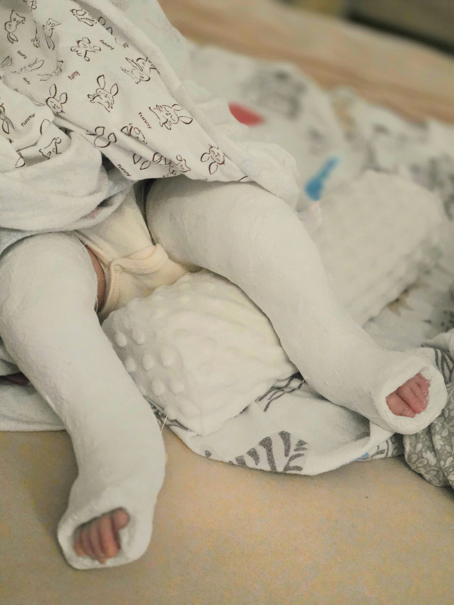 Вот так выглядят наши ножки сейчас.