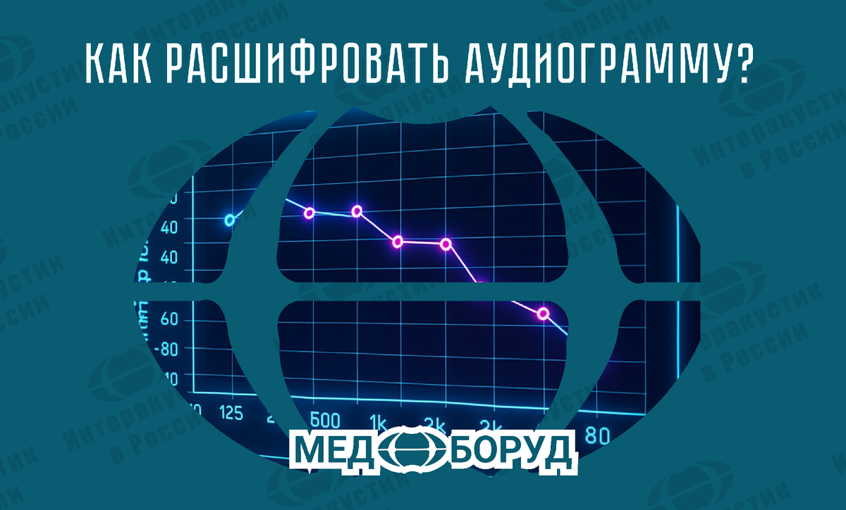 #Аудиограмма #Расшифровка_аудиограммы #лор_оборудование #Поверка_Аудиометров #Ремонт_Оборудования #медицинскаятехника #Отоларингология #Сурдология #Тимпанометрия #Отоакустическая_Эмиссия #ABR #QuickSIN