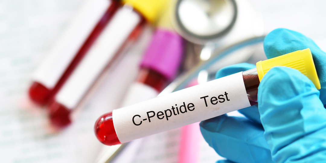 Что такое С-пептид и зачем его сдавать?