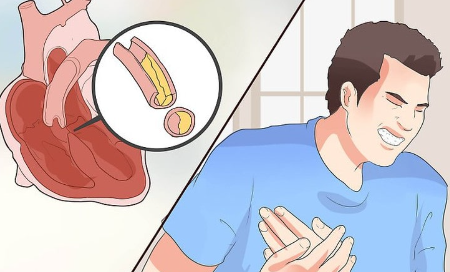 ИБС без воды