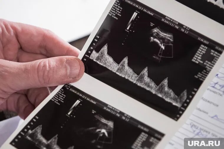 Самой молодой девочка, решившейся на аборт, было 14 лет. Фото: Владимир Жабриков © URA.RU