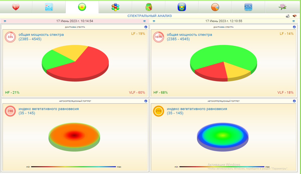 Слева - чрезмерно повышена активность симпатической нервной системы