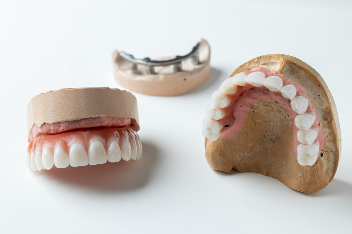 Протезы All-on-4