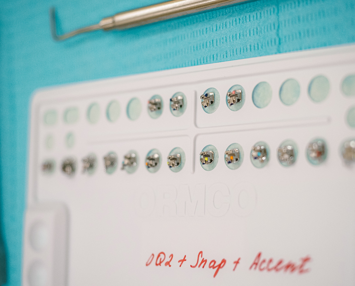 Так выглядят брекеты - маленькие элементы, которые крепятся к зубам. 