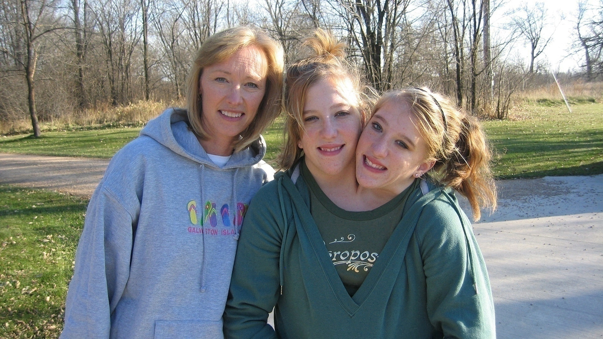 Близнецы-дицефалы — редкое явление, при котором два отдельных мозга развиваются в одном теле с двумя головами. Одним из самых известных примеров таких близнецов являются Эбигейл и Бриттани Хенсел — сёстры, которые удивляют мир своей уникальной физиологией и невероятной жизненной силой. У них один торс, по одной паре рук и ног, трое лёгких, и при этом каждая из них контролирует свою сторону тела и обладает отдельным желудком. Несмотря на все сложности, Эбигейл и Бриттани ведут активную жизнь: получили водительские права, мечтают стать врачами и строят планы на создание семьи. Эта статья расскажет об их удивительном опыте, особенностях организма и вдохновляющем примере преодоления.