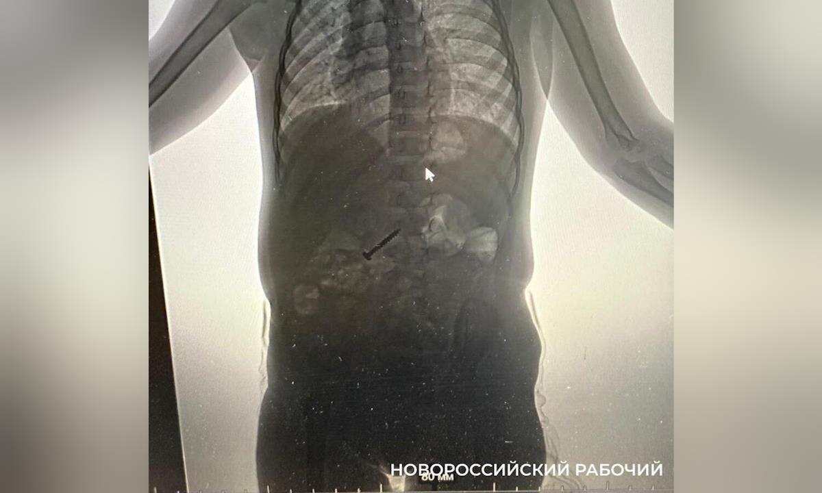    Фото t.me/novorab_official