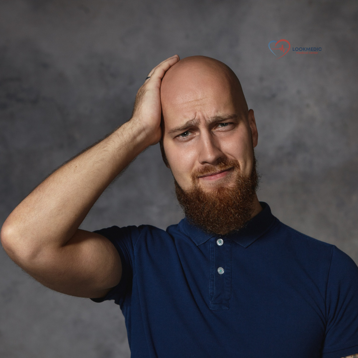 Миф о мужском облысении