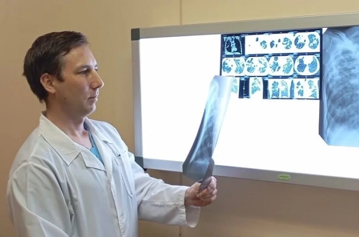    Врачи спасли свердловчанку с тяжёлой формой туберкулёза