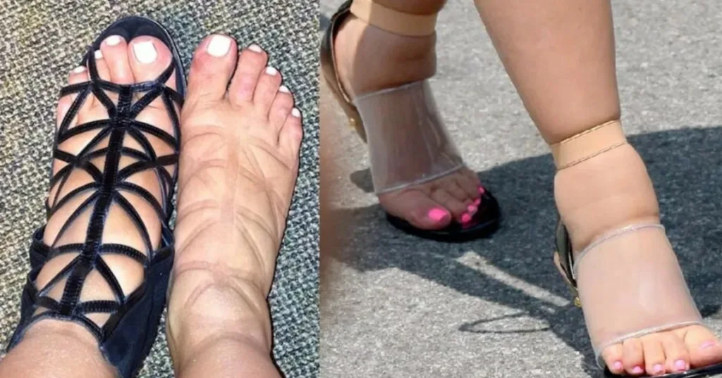 Почему у женщин после 40 отекают ноги