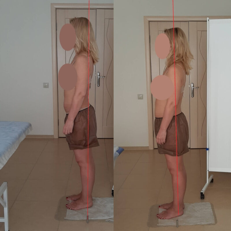 Разница в осанке при смещенном центре массы вперед.