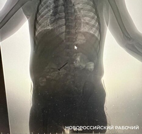    Фото: t.me/novorab_official