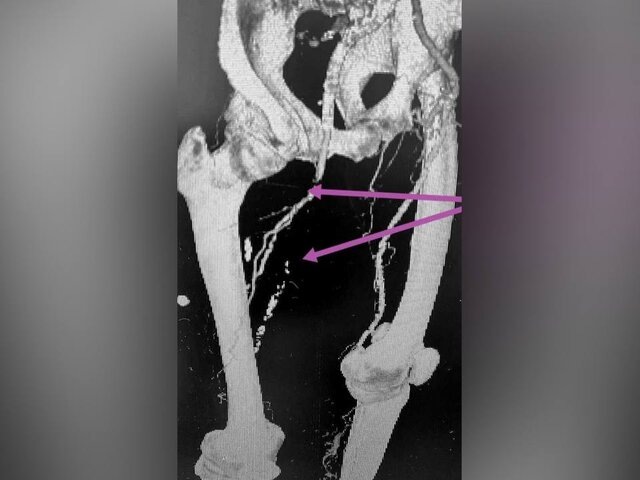    Фото: телеграм-канал "ГБУЗ МО "Долгопрудненская больница"