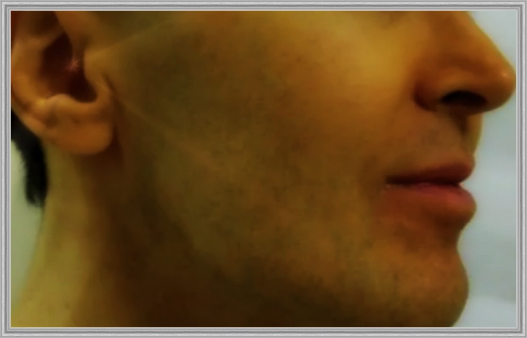 Желтушность кожного покрова.
