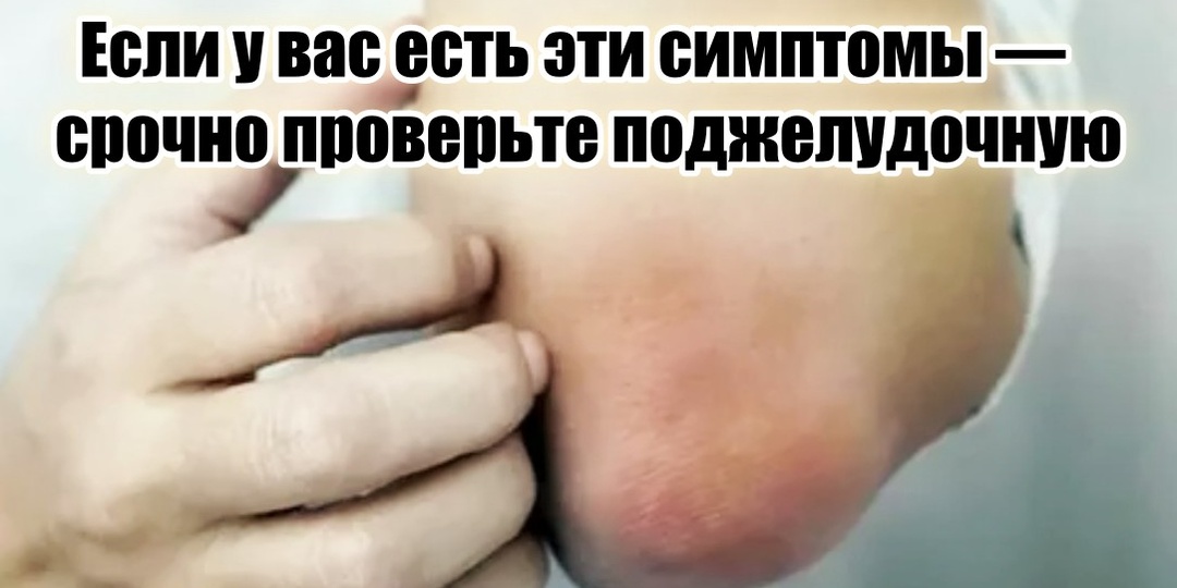 Ваша поджелудочная молит о помощи, а мы в упор не видим: 5 признаков после 50 лет, позволяющих понять, что она на пределе