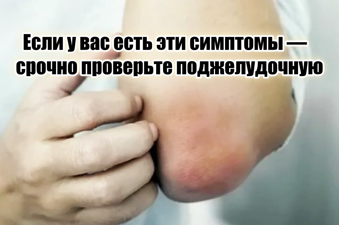 Сухость, зуд, шелушение кожи – один из нехороших сигналов.
