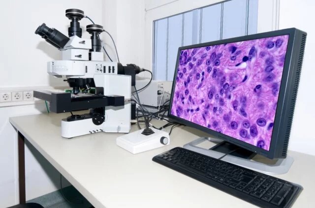    Что такое гистология и для чего ее проводят?