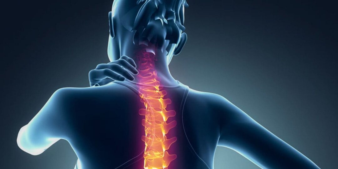 Цервикобрахиалгия: откуда берётся боль в шее и почему не проходит?