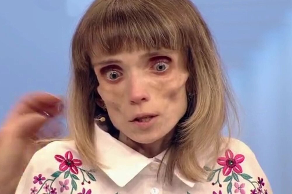    Кристина Корягина из Барнаула поразила всех в студии телепрограммы своим видом. Фото: «Первый канал»/ кадр из видео