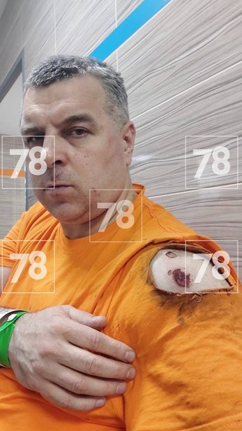    Пострадавший в ходе конфликта охранник ТЦ Автор фото: 78.ru