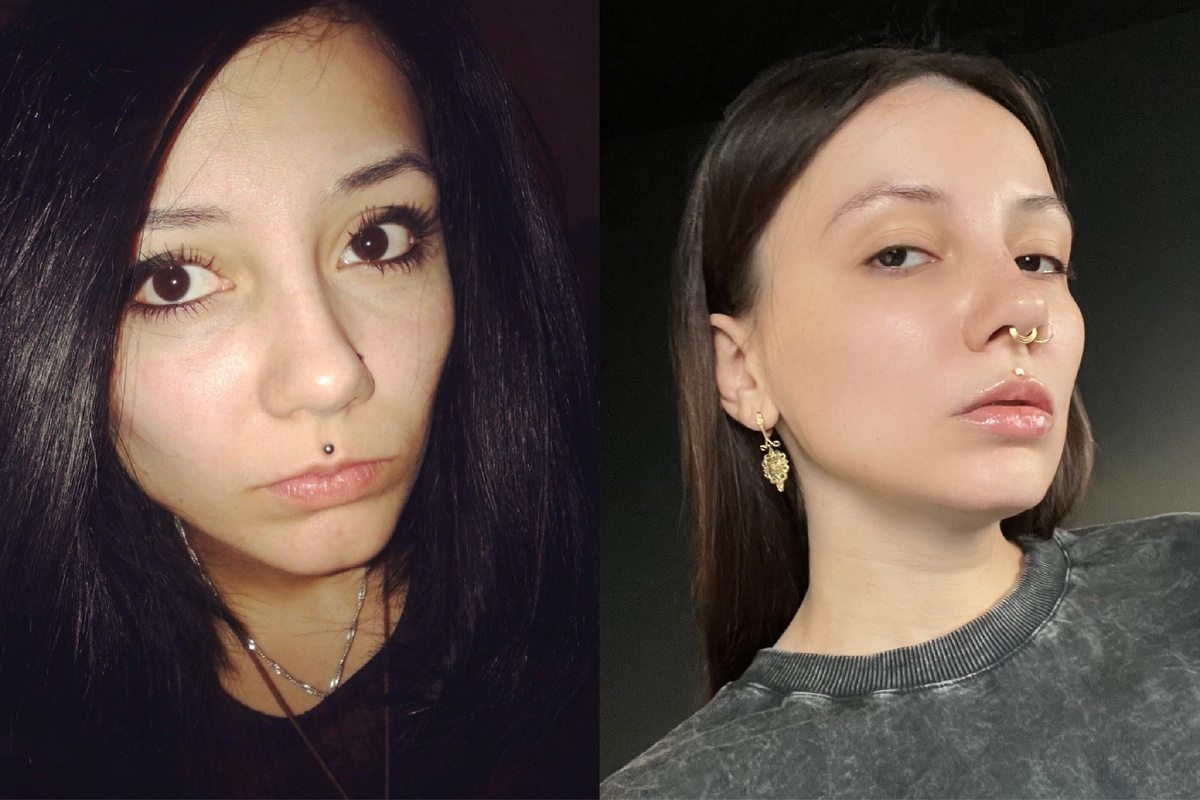 Было/стало (у меня настолько тонкая верхняя губа, что даже две процедуры не смогли сделать из неё вареник)