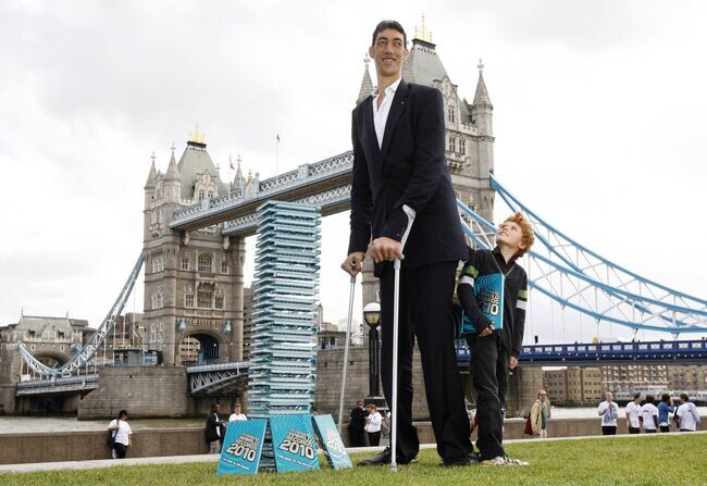 Самым высоким человеком в мире согласно Книге рекордов Гиннеса является турок Султан Кесён. Его рост составляет 251 см, который связан с опухолью гипофиза. В настоящее время он может передвигаться только на костылях. Султан живёт со своими родителями, они оба — нормального роста. Из-за своего роста Султан не смог закончить среднюю школу и был вынужден заниматься фермерством, высокий рост позволяет мужчине с легкостью дотягиваться до вершин деревьев в саду. При этом он любит в компании друзей играть в видеоигры. Недостатками Султан считает  поиск одежды на человека его роста: ему необходимы брюки длиной 153 см и верхняя одежда с рукавами длиной 93 см[7]. Кроме того, ему необходимы ботинки 62 размера, в которых он зачастую не может влезть в средний автомобиль. С 2010 по 2012 г.г. Султан проходил лечение в медицинском университете Виргинии. В результате, которого врачам удалось нормализовать гормональную активность гипофиза и постоянный рост Султана приостановился.