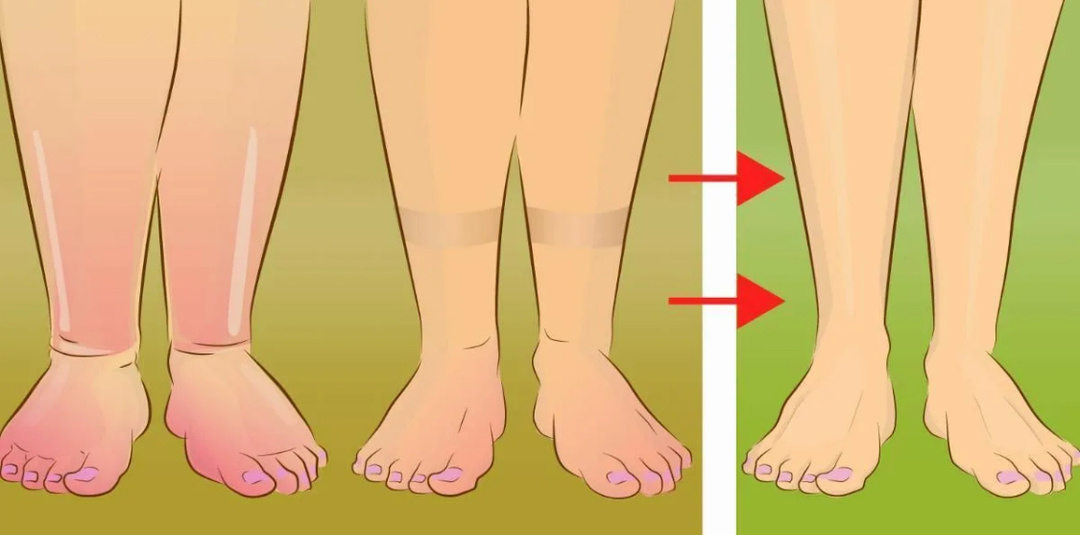 Искала их очень давно: ещё 3 лимфодренажных упражнения, чтобы избавиться от отеков и быстро подтянуть фигуру