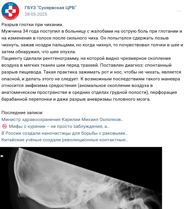    Фейк про разрыв глотки у чихнувшего жителя Карелии разлетелся по СМИЦРБ Суоярви / ВК