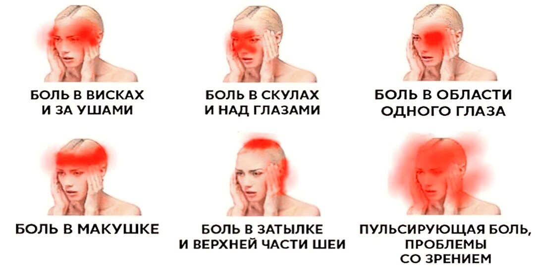 Эти обычные головные боли могут быть симптомом опухоли