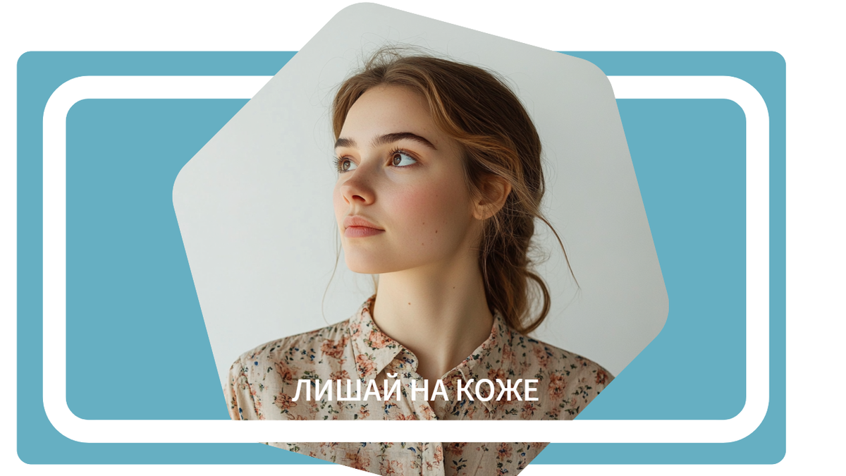 Лишай на коже: какие бывают виды и как их распознать