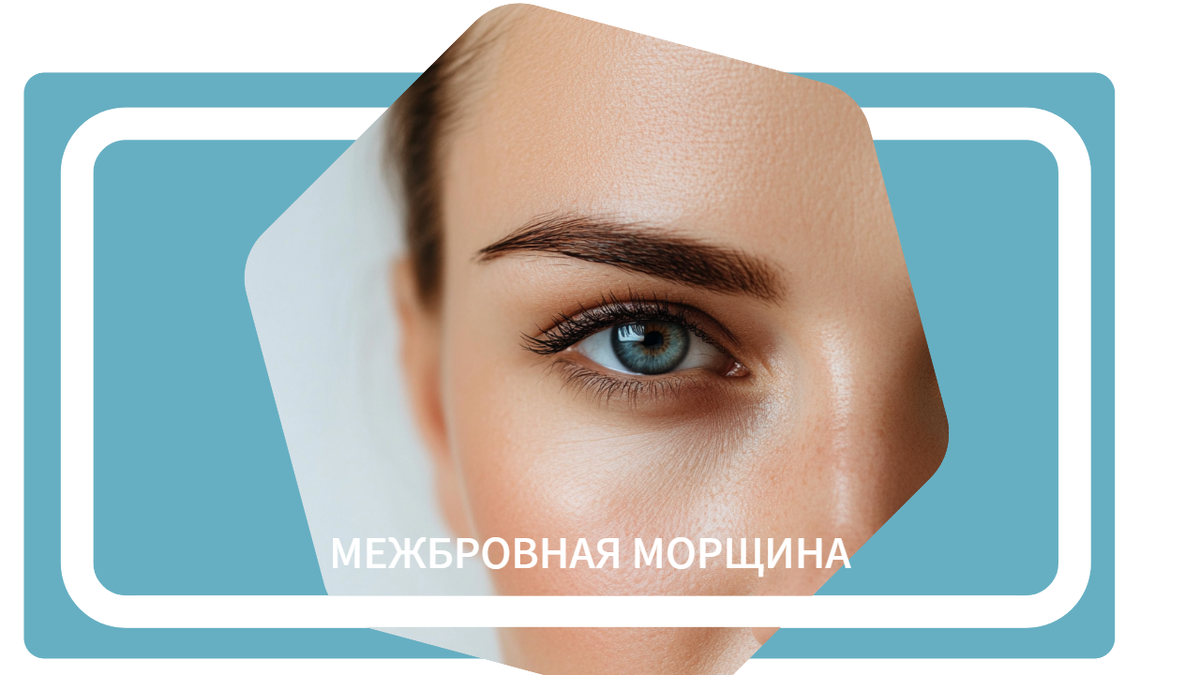 Как убрать межбровную морщину: пошаговый разбор эффективных решений