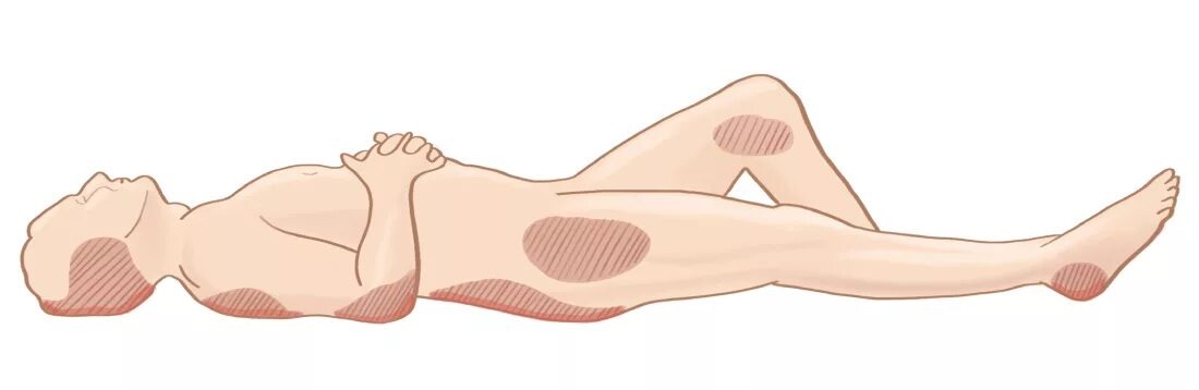 Источник kamo-med.ru