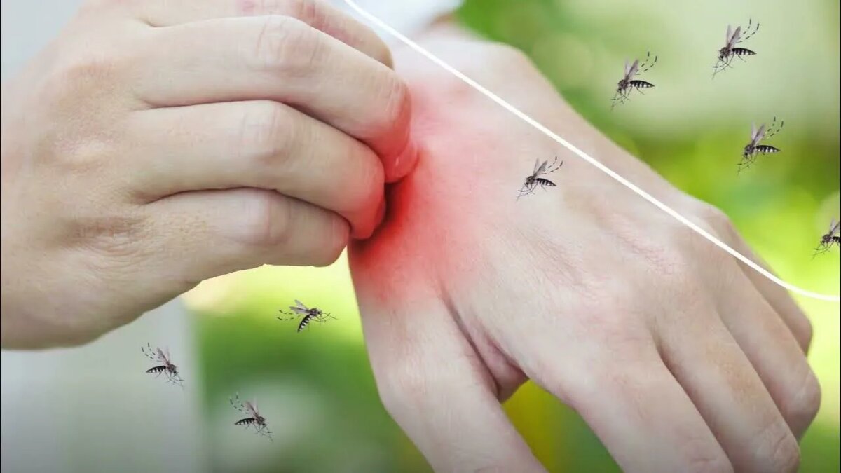Как избавиться от зуда после укуса комара: действенные методы из народной медицины