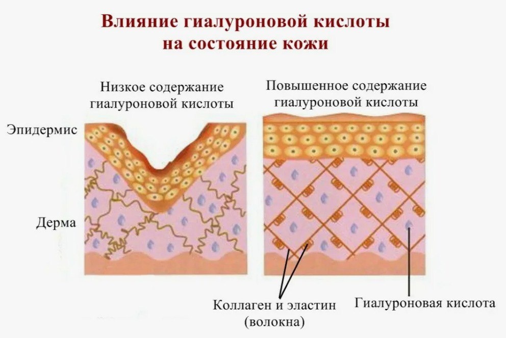 Иллюстрация из открытого Интернет-источника