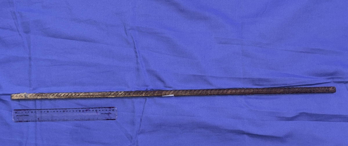   Nandakumar B M et al. / BMJ Case Reports, 2025