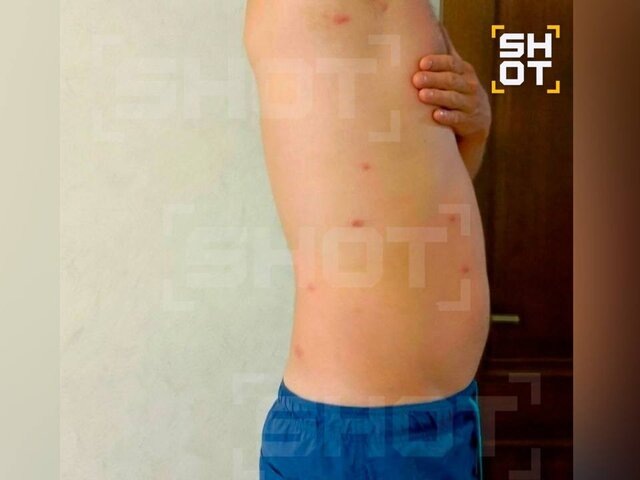    Фото: телеграм-канал SHOT