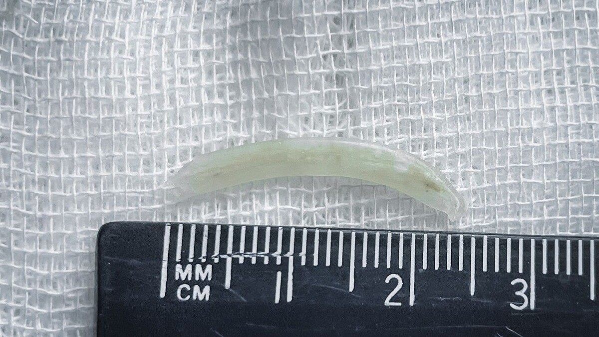    Фото: t.me/kkb2krasnodar