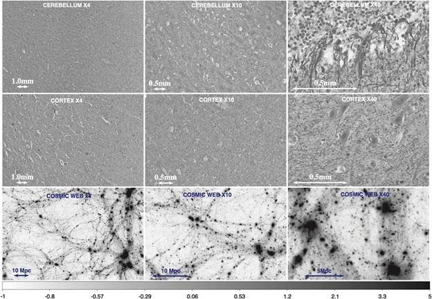 Normaligita   denseco kontrasto mapoj, δρ ekzemploj de sekcioj de la cerebelo (top row),   cerebral cortex (meza vico), kaj malluma materio distribuon en la kosma   retejo (malsupra vico) por malsamaj pligrandigon niveloj estas donita. La   spektra kaj reto analizo prezentita en tiu papero plejparte fokuso sur 40×   ekzemploj, kiel en la dekstra mano paneloj.  [5], fotoj [5]